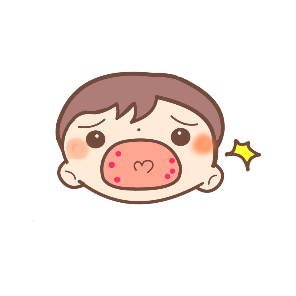 ヘルパンギーナに感染 保育園の対応